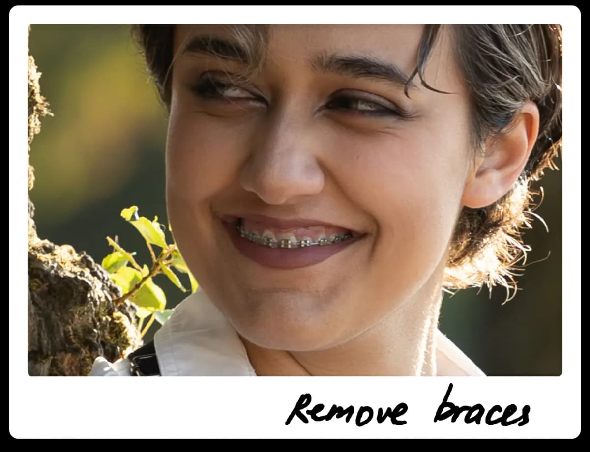 Remove braces demo